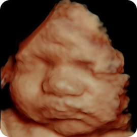 HD Ultrasound