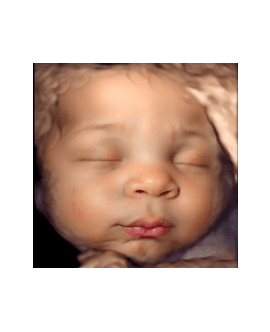 RealView-Images