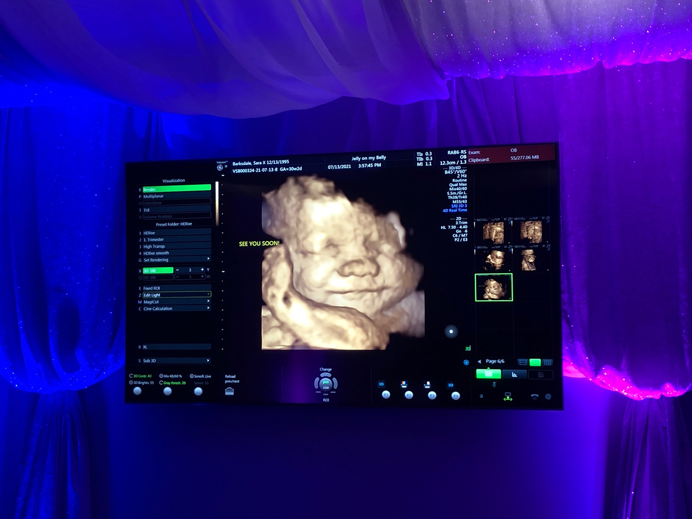 A baby smiling in a 3D ultrasound close-up